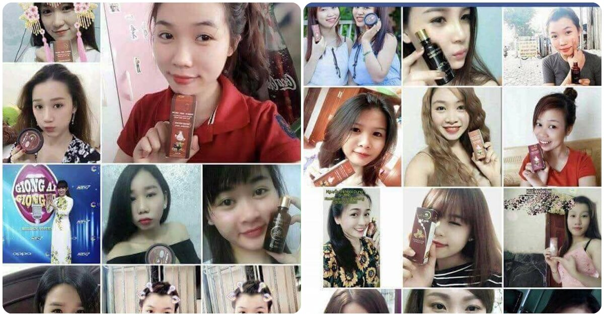 Thuốc trị mụn đông y Thanh Trang giúp làn da "lột xác" như thế nào? Thuốc trị mụn đông y Thanh Trang giúp làn da "lột xác" như thế nào?