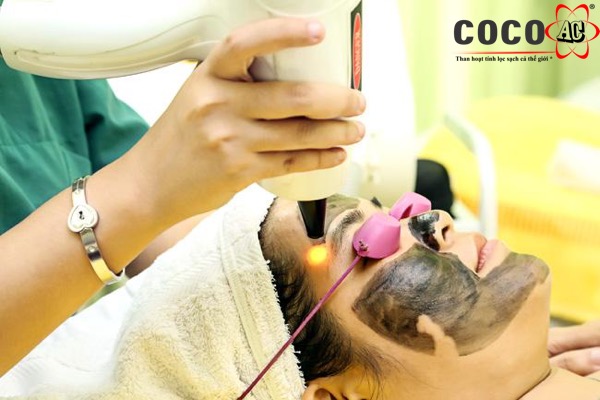 laser than hoạt tính laser than hoạt tính