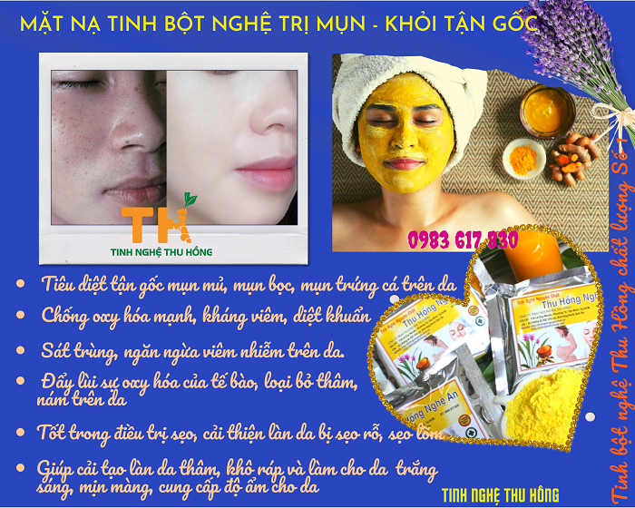 Trị mụn bằng nghệ tươi sẽ không hiệu quả như tinh bột nghệ Trị mụn bằng nghệ tươi sẽ không hiệu quả như tinh bột nghệ