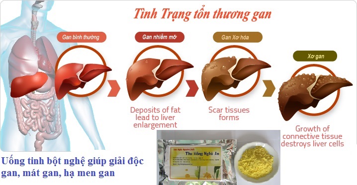 Curcumin giúp làm sạch gan lọc máu Curcumin giúp làm sạch gan lọc máu