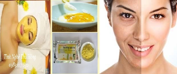 Tinh nghệ Thu Hồng trị tàn nhang hiệu quả Tinh nghệ Thu Hồng trị tàn nhang hiệu quả