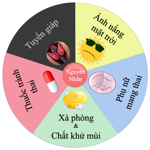 Nguyên nhân gây nám da Nguyên nhân gây nám da