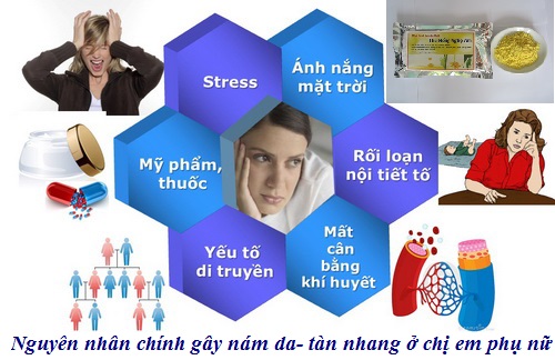 Nguyên nhân gây nên nám da Nguyên nhân gây nên nám da