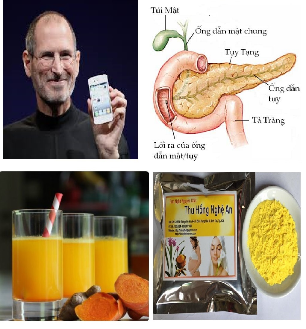 Ung thư tuyến tuỵ chữa khỏi nhờ Tinh nghệ curcumin