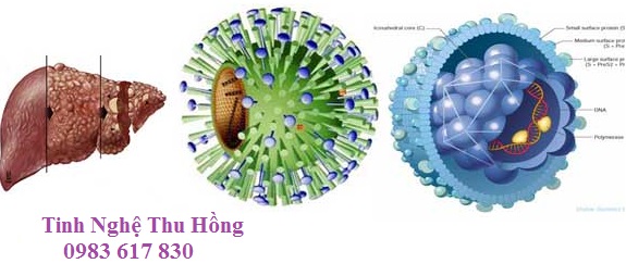 Viêm gan B Viêm gan B