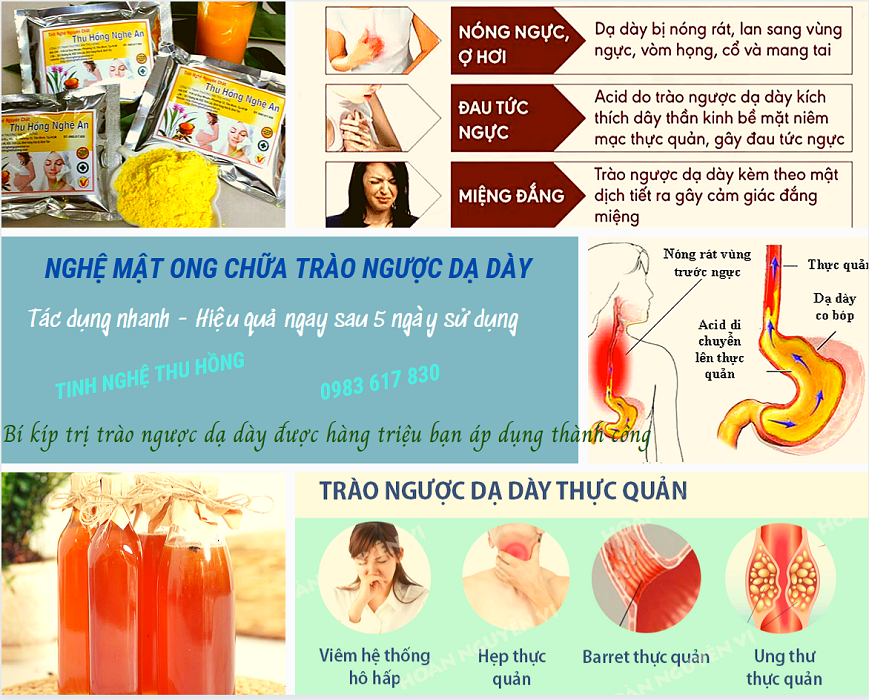 Nghệ chữa trào ngược dạ dày vô cùng hiệu quả Nghệ chữa trào ngược dạ dày vô cùng hiệu quả