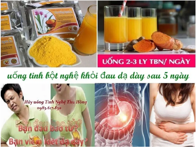 Chữa viêm loét dạ dày bằng tinh bột nghệ khỏi nhanh sau 5 ngày Chữa viêm loét dạ dày bằng tinh bột nghệ khỏi nhanh sau 5 ngày