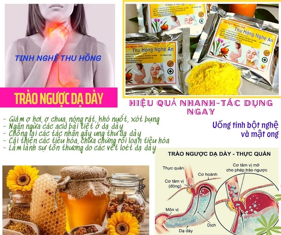 Nghệ chữa trào ngược dạ dày khỏi nhanh và hiệu quả Nghệ chữa trào ngược dạ dày khỏi nhanh và hiệu quả