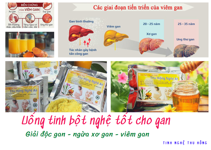 Công dụng của củ nghệ vàng giúp giải độc gan Công dụng của củ nghệ vàng giúp giải độc gan
