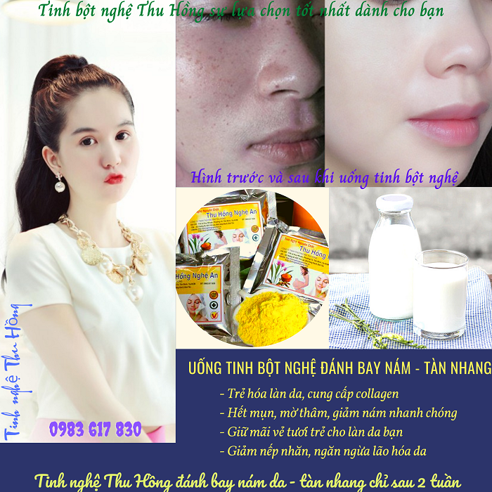 Áp dụng cách uống tinh bột nghệ đẹp da - giúp da trắng mịn Áp dụng cách uống tinh bột nghệ đẹp da - giúp da trắng mịn