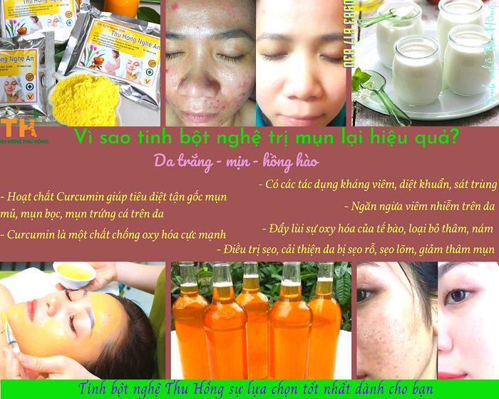 Vì sao tinh bột nghệ trị mụn lại hiệu quả đến thế? Vì sao tinh bột nghệ trị mụn lại hiệu quả đến thế?