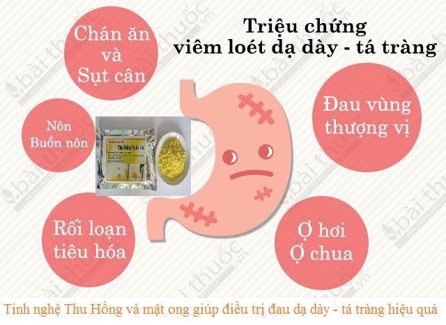 Nguyên nhân gây dau dạ dày Nguyên nhân gây dau dạ dày