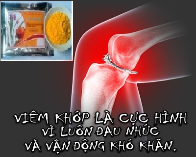 Tinh nghệ Curcumin niềm vui cho người bệnh viêm khớp Tinh nghệ Curcumin niềm vui cho người bệnh viêm khớp