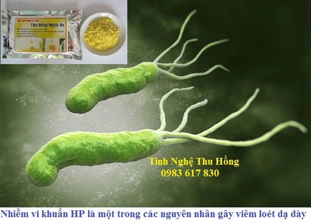 Vi khuẩn HP là nguyên nhân gây đau dạ dày cấp tính Vi khuẩn HP là nguyên nhân gây đau dạ dày cấp tính