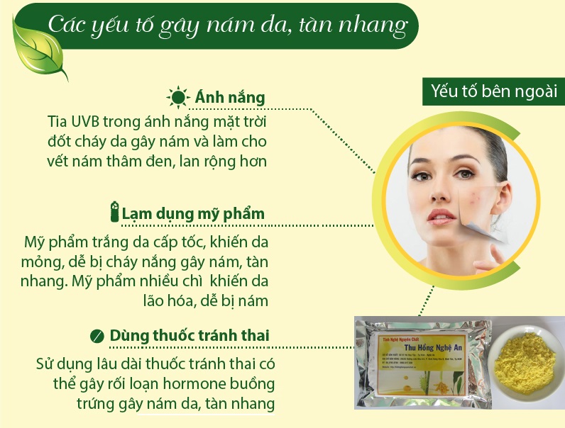 Nguyên nhân gây nám da Nguyên nhân gây nám da