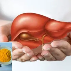 Tinh bột nghệ giúp giải độc gan cho người uống rượu bia