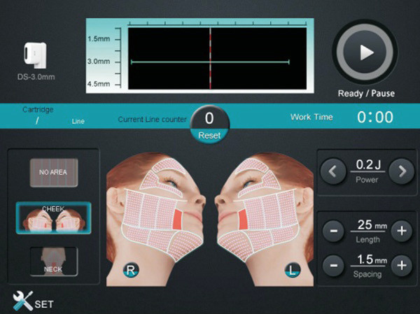 Máy HIFU 3S Nâng Cơ Xóa Nhăn FU4.5-3S Máy HIFU 3S Nâng Cơ Xóa Nhăn FU4.5-3S