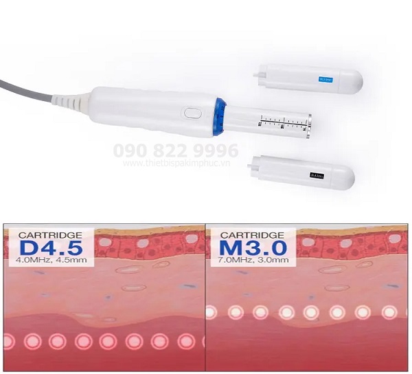 Máy HIFU Trẻ Hóa Âm Đạo Hironic Máy HIFU Trẻ Hóa Âm Đạo Hironic