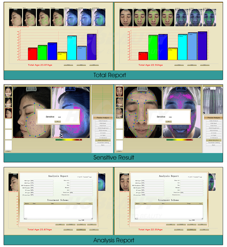 Máy Phân Tích Da LD-6021  Máy Phân Tích Da LD-6021