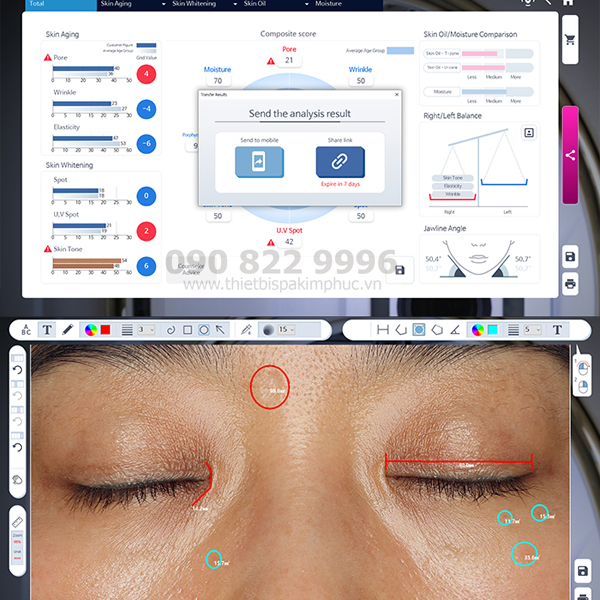 Máy Phân Tích Da Janus Pro Hybrid Hàn Quốc Máy Phân Tích Da Janus Pro Hybrid Hàn Quốc