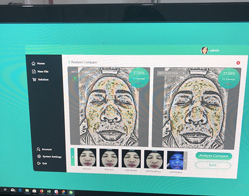 Máy Phân Tích Da Tiếng Việt M1 Máy Phân Tích Da Tiếng Việt M1