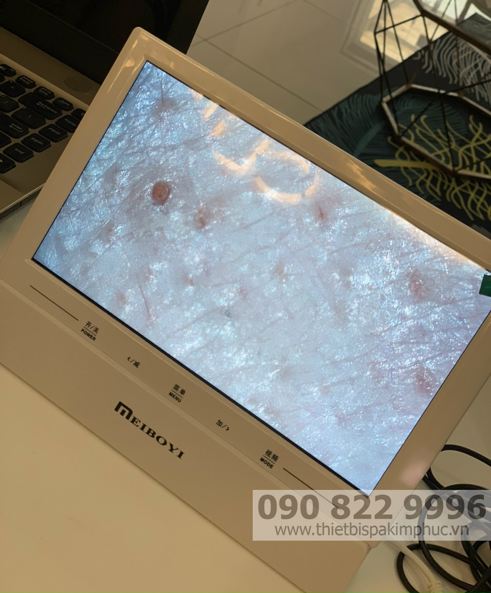 Máy soi da LCD Meiboyi Máy soi da LCD Meiboyi