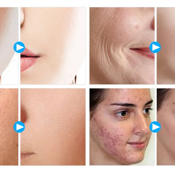 Máy Ánh Sáng Sinh Học HRCSKIN