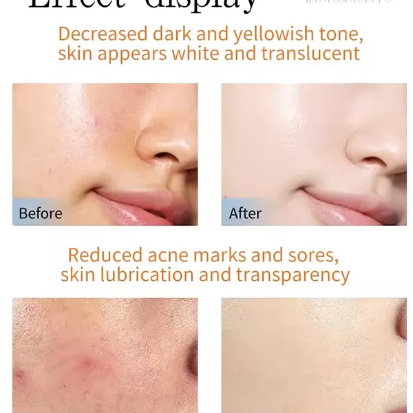 Máy Aqua Peel Dermaspa