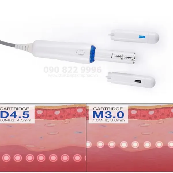 Máy HIFU Trẻ Hóa Âm Đạo Hironic
