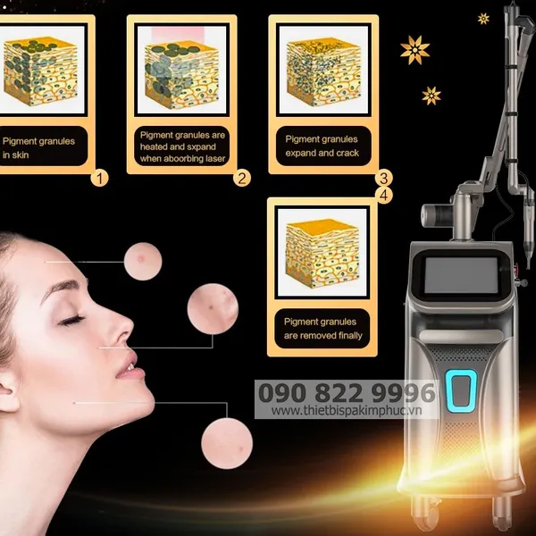 Máy Laser Picosecond Q-Switched ND