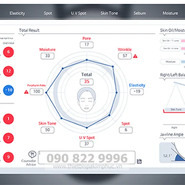 Máy Phân Tích Da Janus III