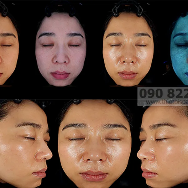 Máy Phân Tích Da Janus Pro Hybrid