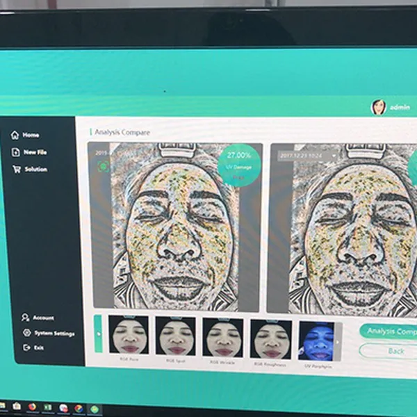 Máy Phân Tích Da Tiếng Việt M1