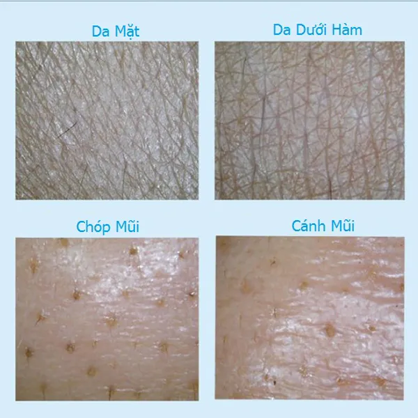 Máy Soi Da Màn Hình LCD 9 Inch