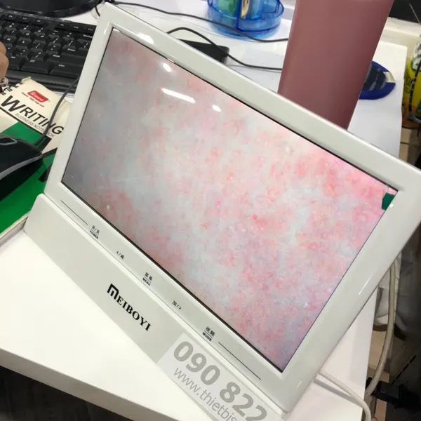 Máy Soi Da LCD MEIBOYI