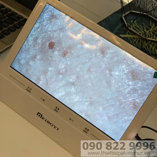 Máy Soi Da LCD MEIBOYI