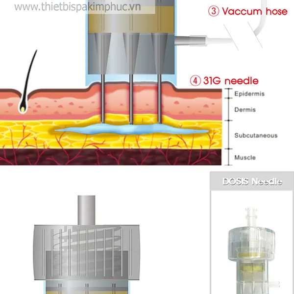 Máy Tiêm Dưỡng Chất Hydro Injector