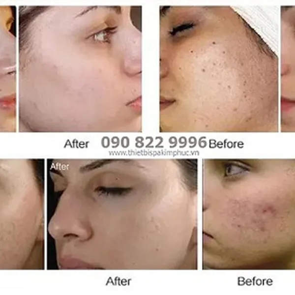 Máy Vi Kim Điện M5 Dr Pen