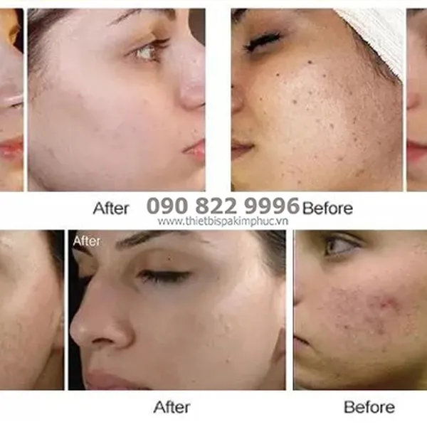 Máy Vi Kim Điện M7 Dr Pen