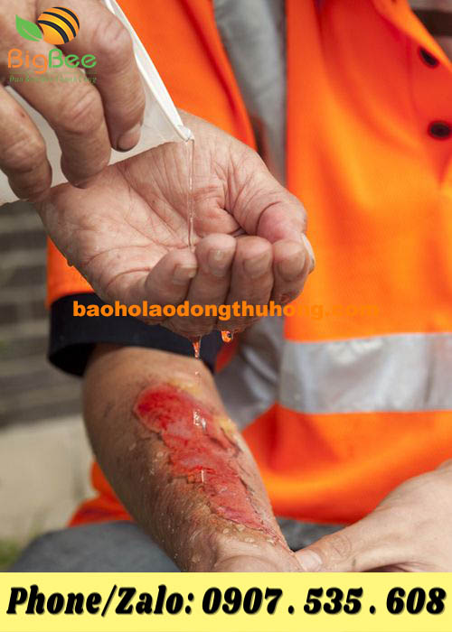 Nghề thợ hàn nguy hiểm như thế nào?