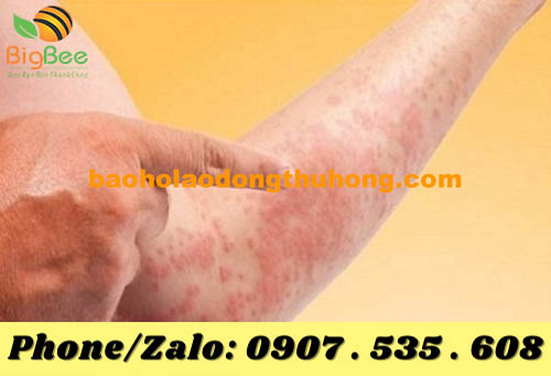 tác hại của ánh nắng khói bụi đối với làn da