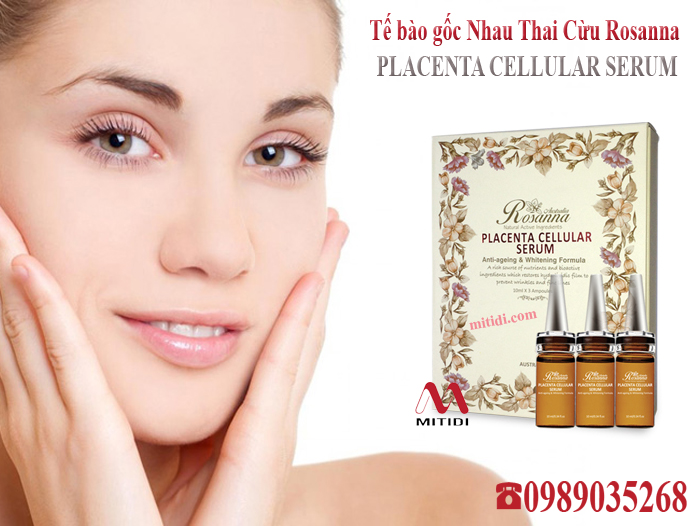 Tế bào gốc nhau thai cừu Rosanna Placenta Cellular Serum Mitidi-te-bao-goc-nhau-thai-cuu-rosanna-placenta-cellular-serum-04.jpg (258 KB)