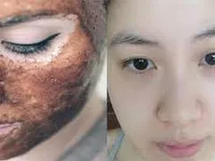 10 Cách Tẩy Tế Bào Chết Cho Da Mặt Từ Thiên Nhiên