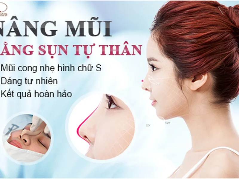 Nâng Mũi Bằng Sụn Tự Thân - Duy Trì Dáng Mũi Đẹp Thách Thức Cùng Thời Gian