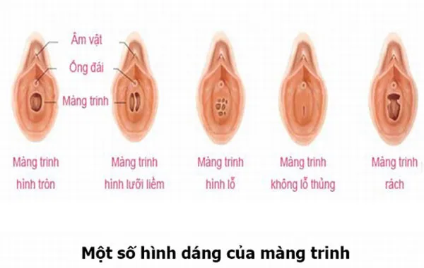 Tại sao có người cần uống thuốc giảm đau khi quan hệ lần đầu?
