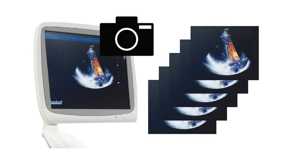 Thiết bị ghi hình Avermedia EzRecorder 530 Thiết bị ghi hình Avermedia EzRecorder 530