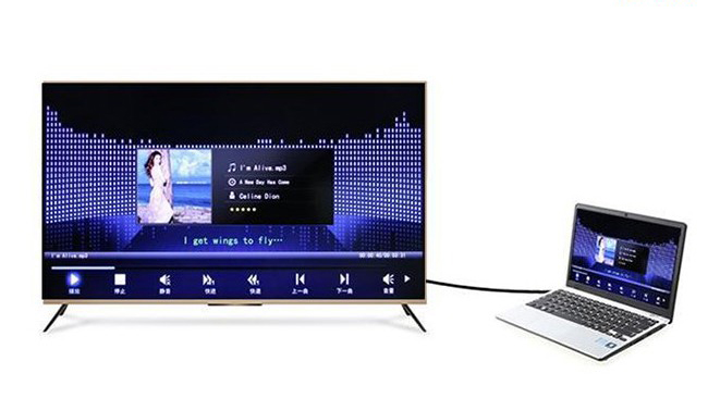 Cáp âm thanh 1 ra 2 RCA 3M Ugreen 10590 Cáp âm thanh 1 ra 2 RCA 3M Ugreen 10590