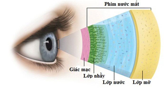 Nguyên nhân gây khô mắt