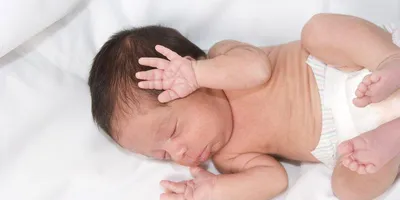 TỔNG HỢP 48 HIỆN TƯỢNG SINH LÝ THƯỜNG GẶP Ở TRẺ VÀ CÁCH CHỮA CỰC HỮU ÍCH CHO MẸ