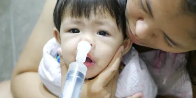 MẸ DÙNG XILANH BƠM NƯỚC MUỐI TỰ RỬA MŨI CHO CON TẠI NHÀ, BÉ 2.5 THÁNG TUỔI NGỪNG THỞ, TÍM TÁI TOÀN THÂN